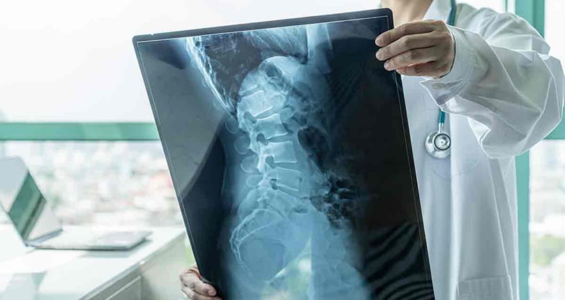 Мифы о боли в спине - рентген